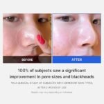 MEDICUBE Zero Pore Pad, 155g/70pads - Image 4